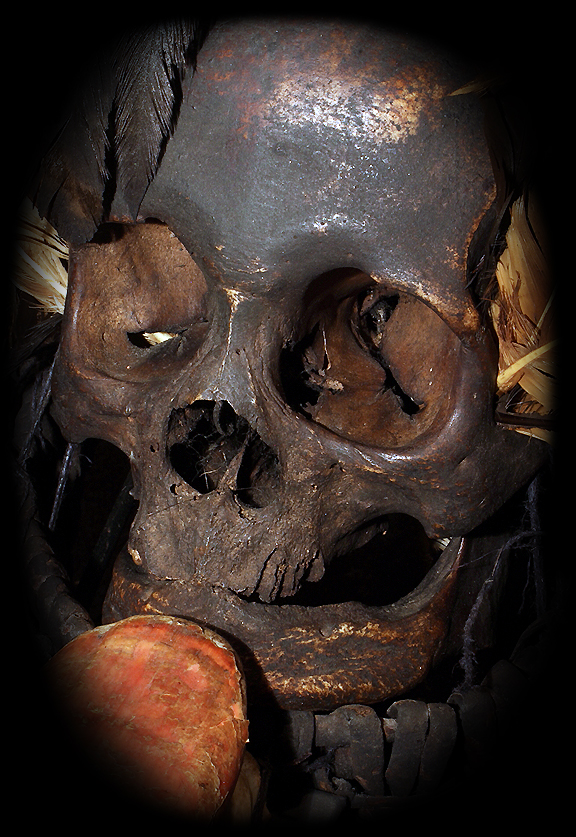 Head Hunting Human Trophy Skull Ifugao Tribe Philippines