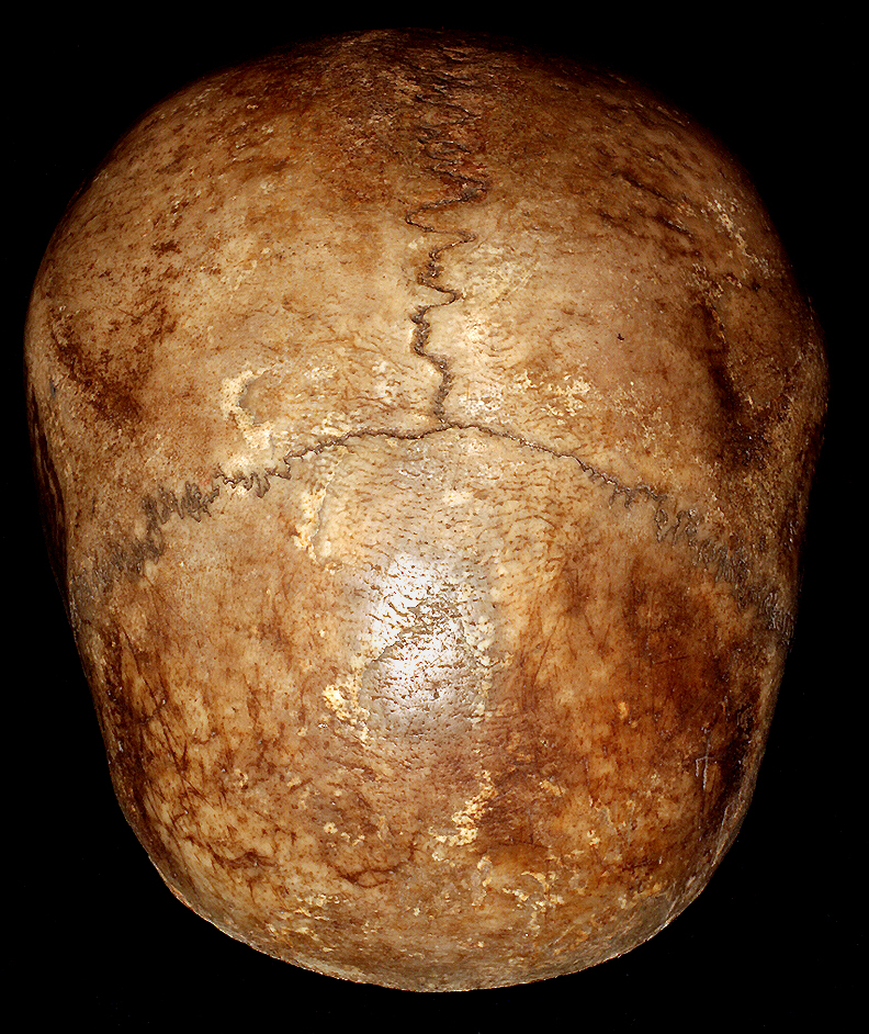 REAL HUMAN SKULL CAP KAPALA